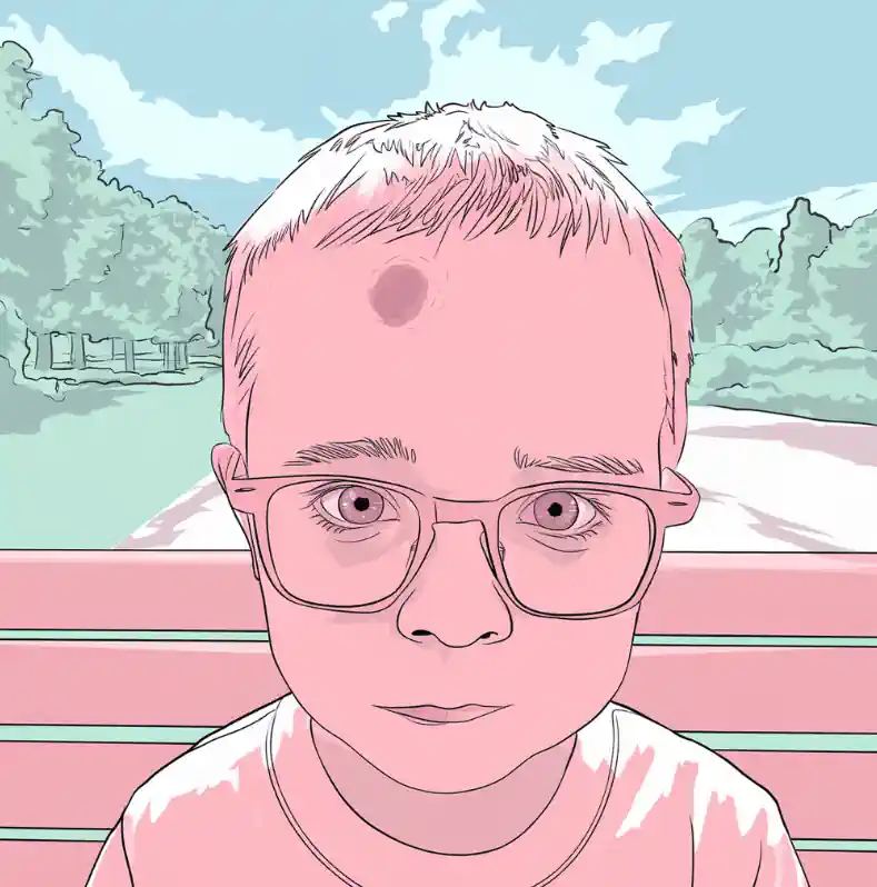 image of a child with a bump on the head